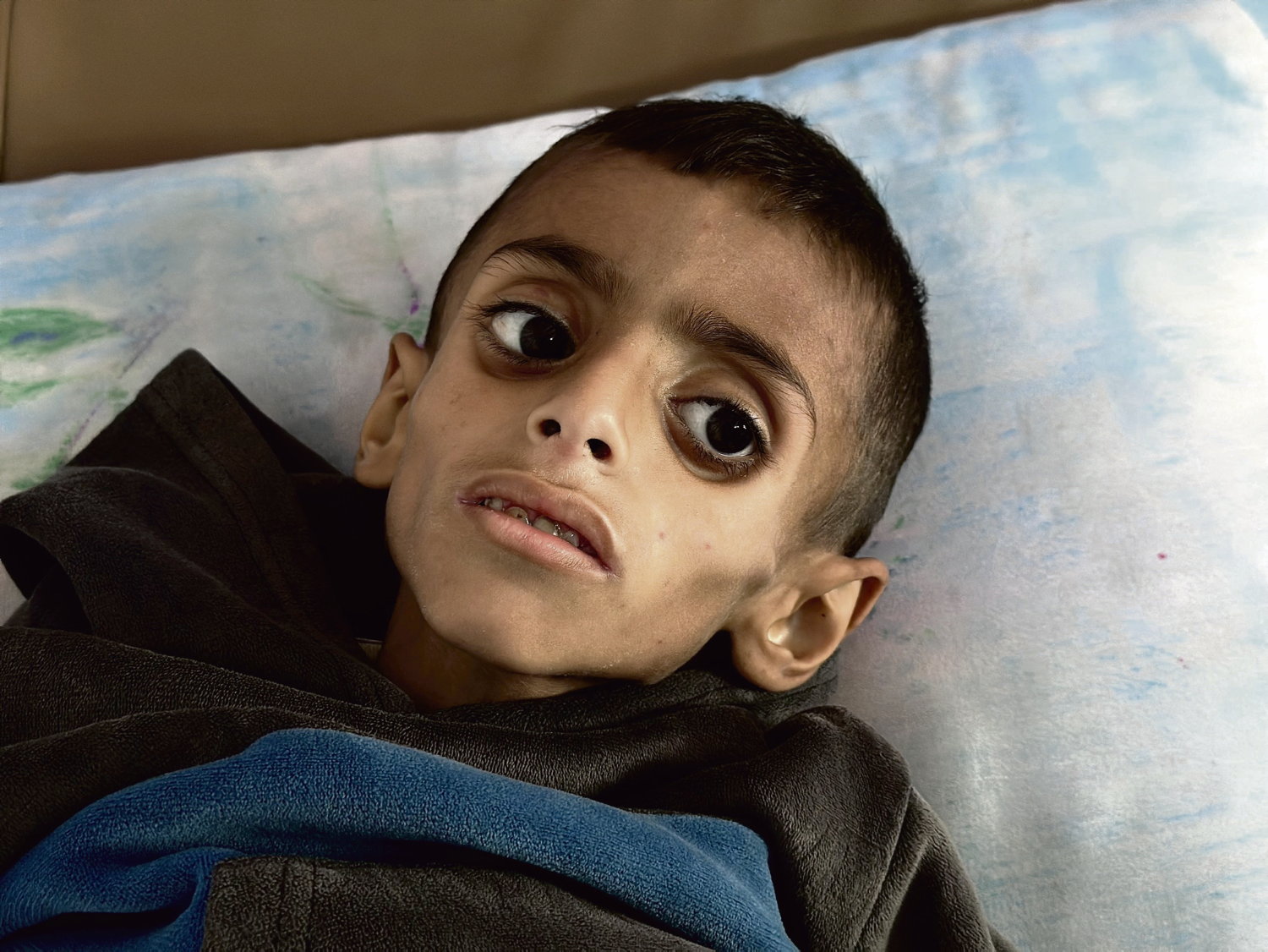 La négation systématique de la famine à Gaza par les partisans d’Israël